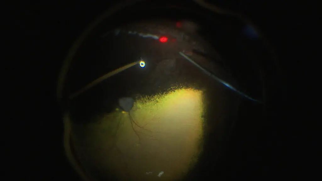Pet retina information